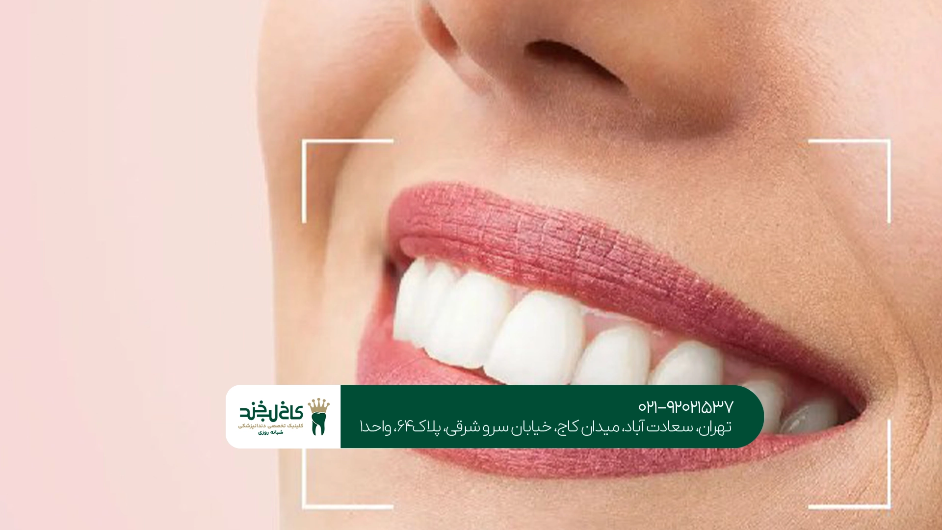 مزایای طراحی لبخند دیجیتال
