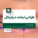 طراحی لبخند دیجیتال