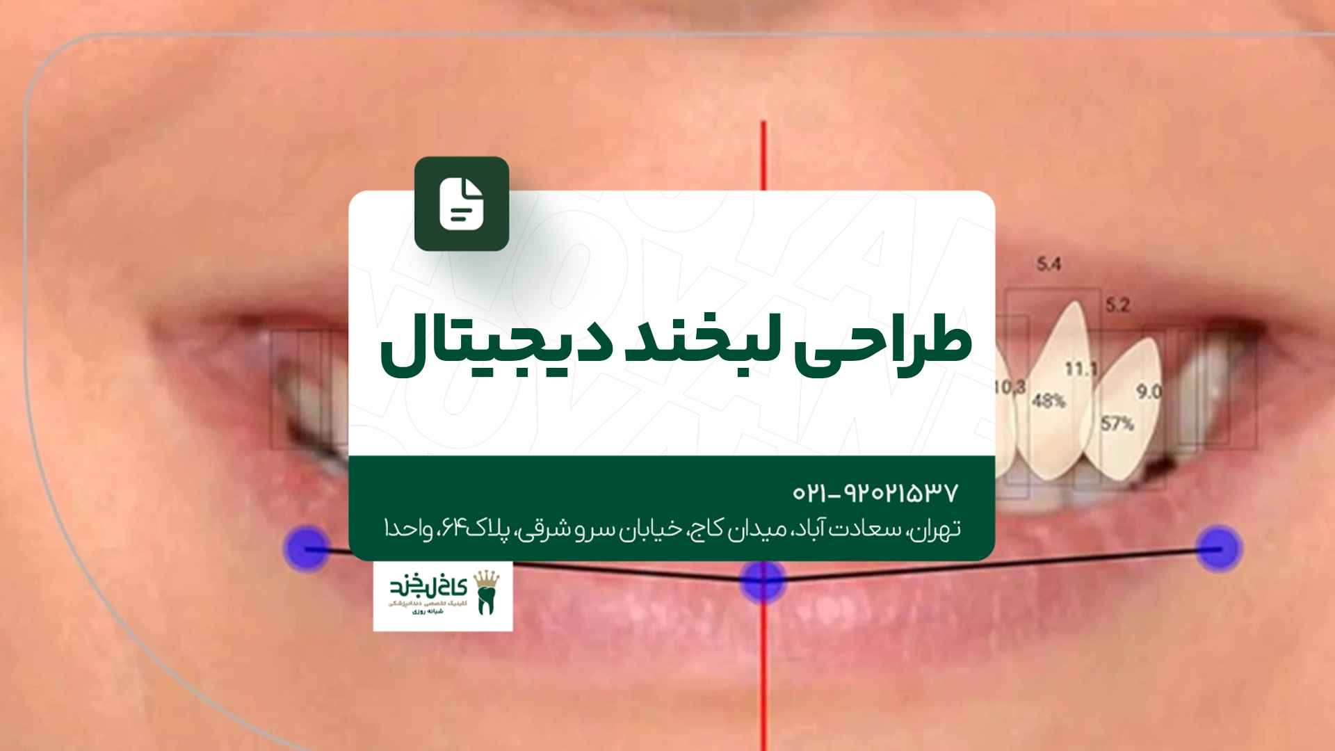طراحی لبخند دیجیتال