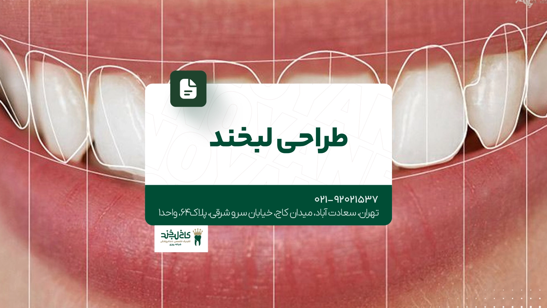 طراحی لبخند