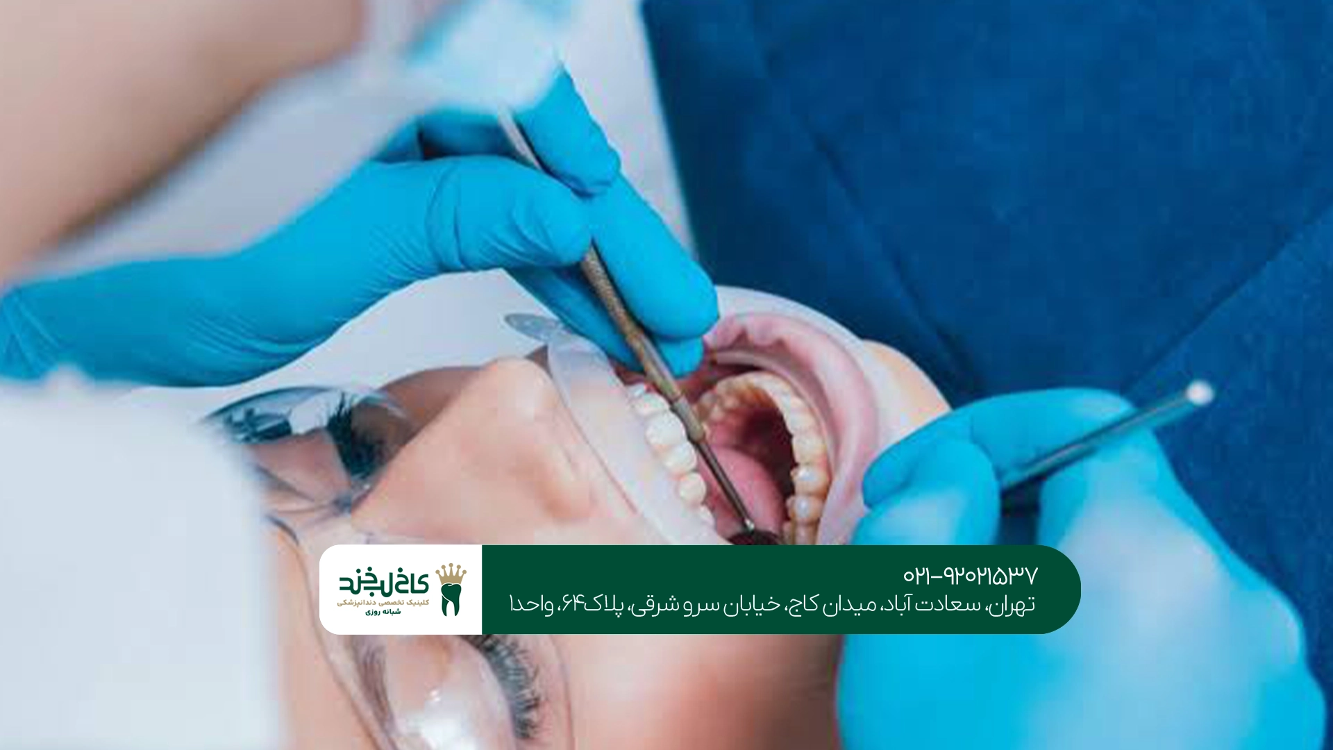 مراقبت بعد از عصب کشی