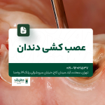 عصب کشی دندان