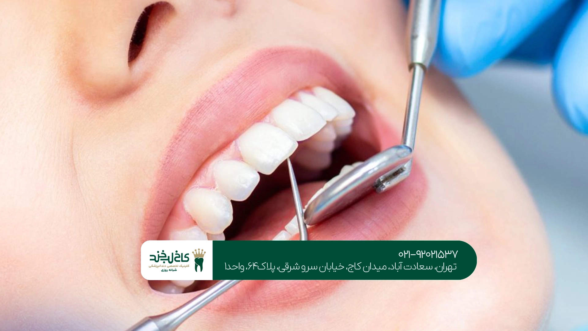 عصبکشی دندان چیست؟ عصبکشی دندان چیست؟