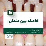 فاصله بین دندان