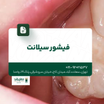 فیشور سیلانت