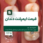 قیمت ایمپلنت دندان
