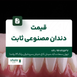 قیمت دندان مصنوعی ثابت