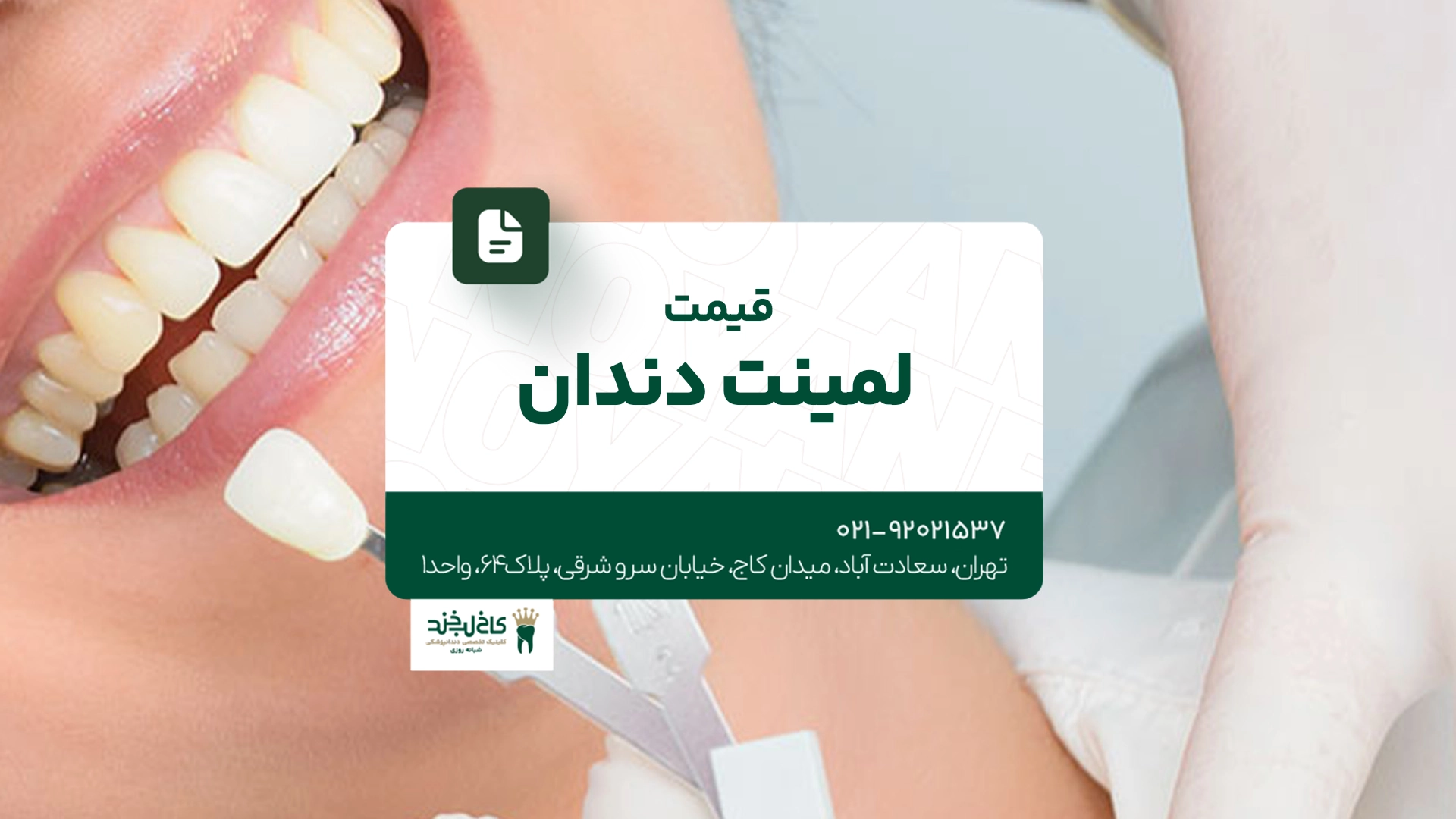 قیمت لمینت دندان قیمت لمینت دندان