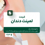 قیمت لمینت دندان