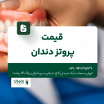 قیمت پروتز دندان