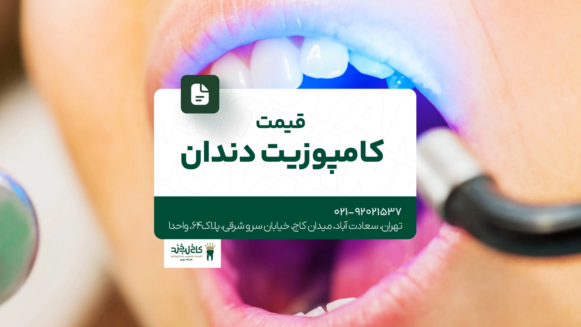 قیمت کامپوزیت دندان