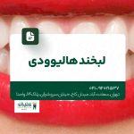 لبخند هالیوودی