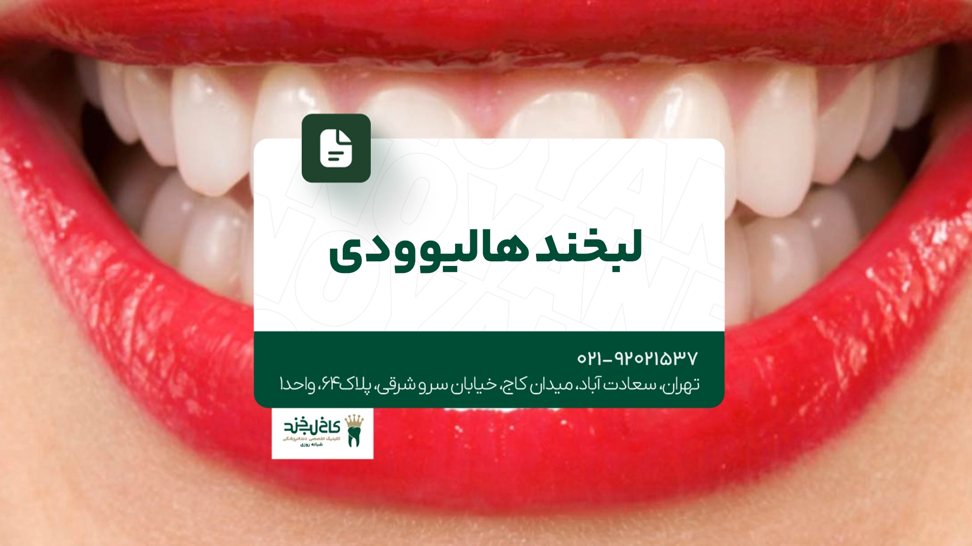لبخند هالیوودی لبخند هالیوودی