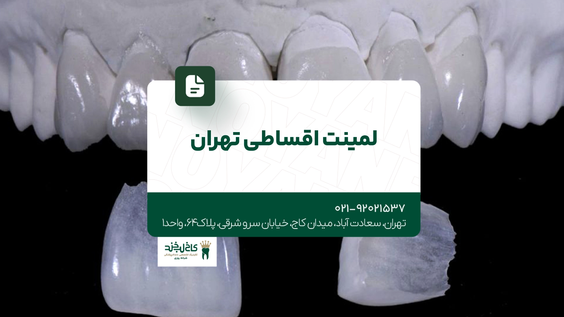 لمینت اقساطی تهران لمینت اقساطی تهران