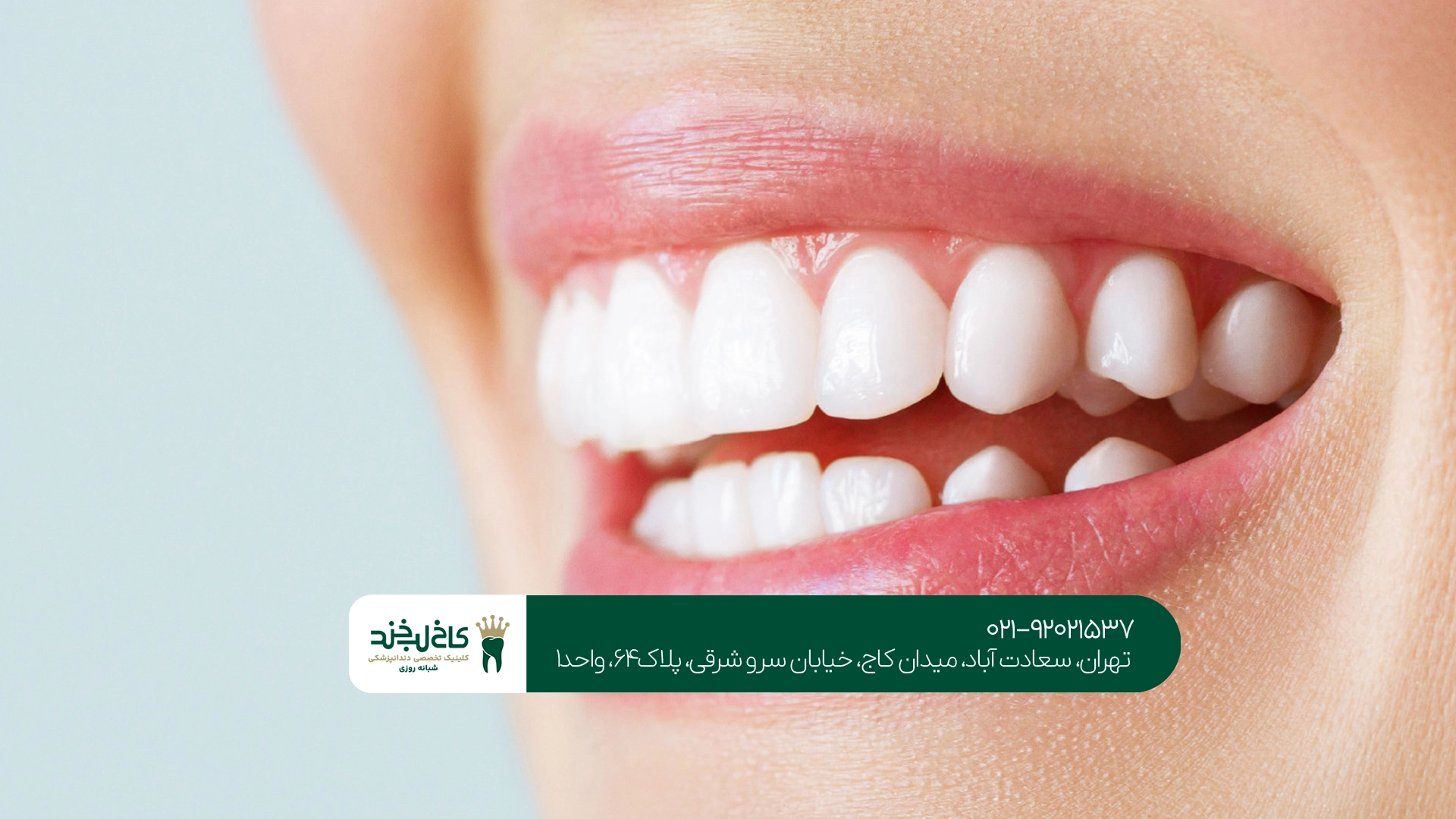 لمینت اقساطی در تهران لمینت اقساطی در تهران