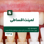 لمینت اقساطی