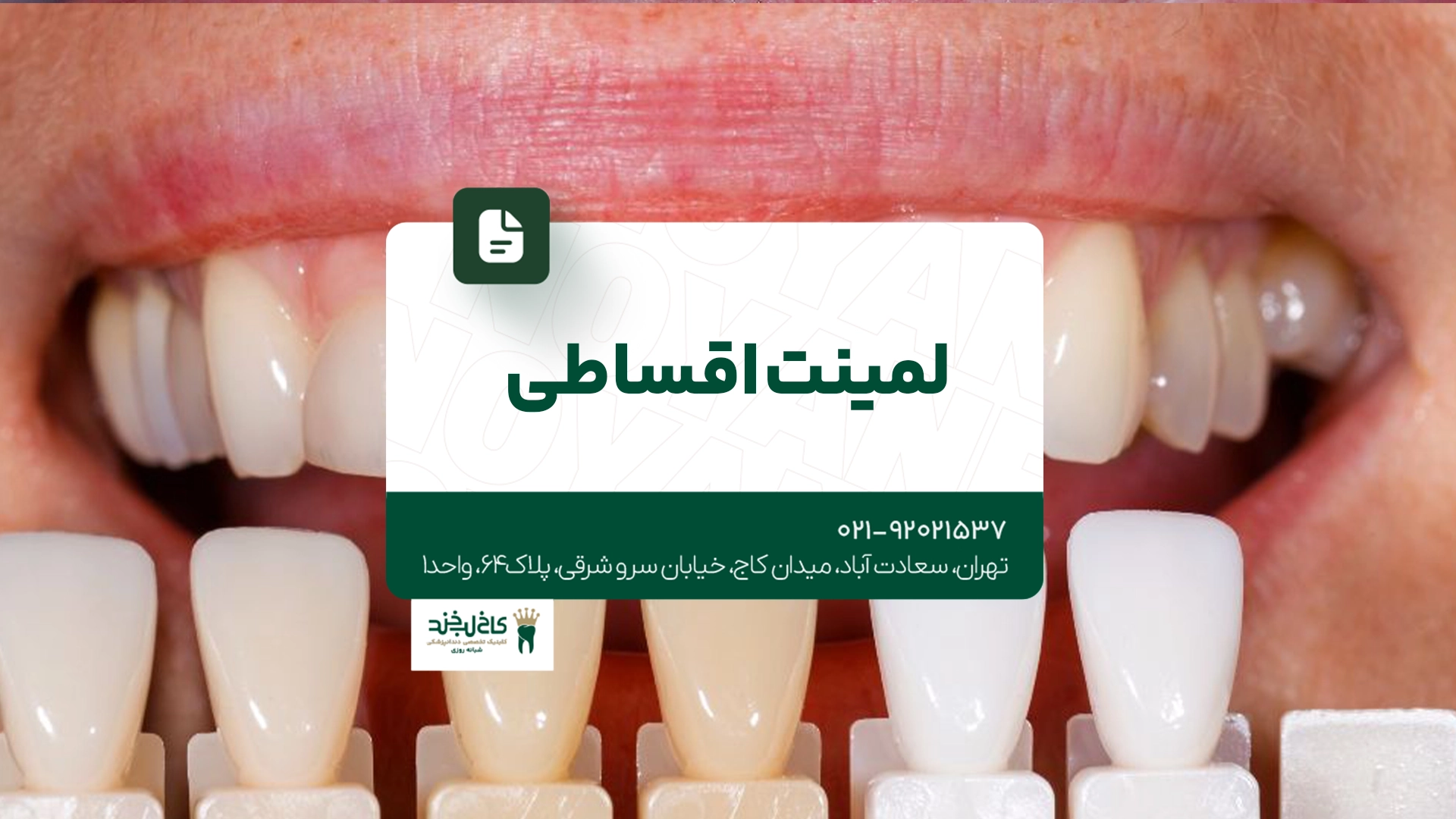لمینت اقساطی