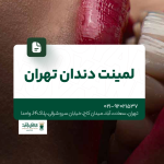 لمینت دندان تهران