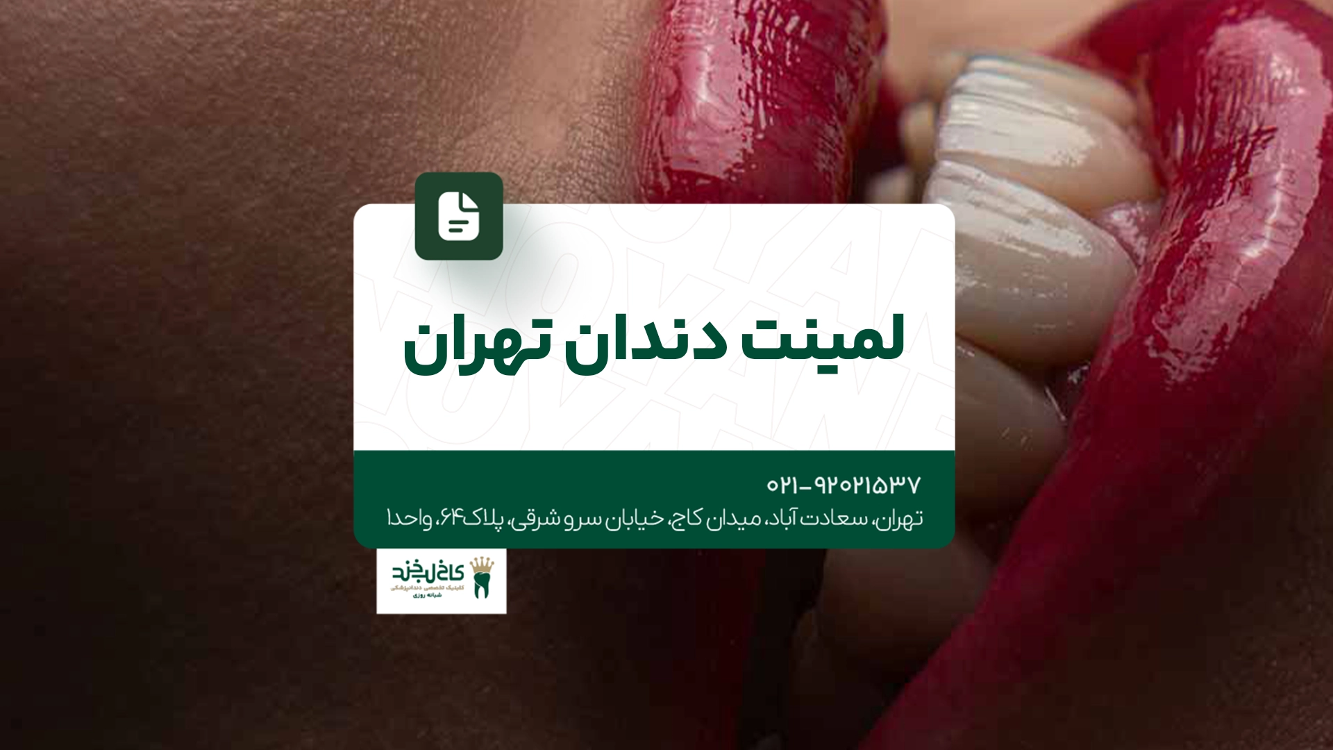 لمینت دندان تهران