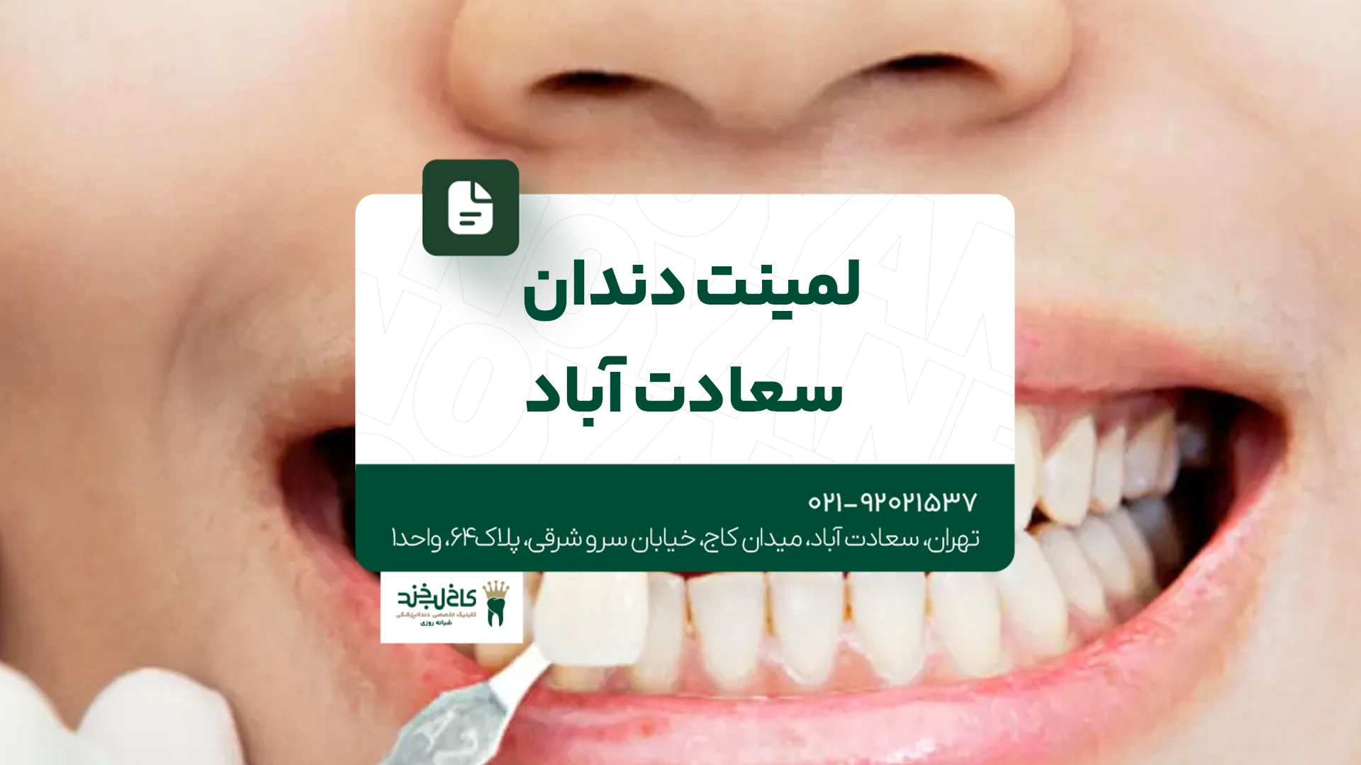 لمینت دندان سعادت آباد لمینت دندان سعادت آباد