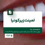 لمینت زیرکونیا