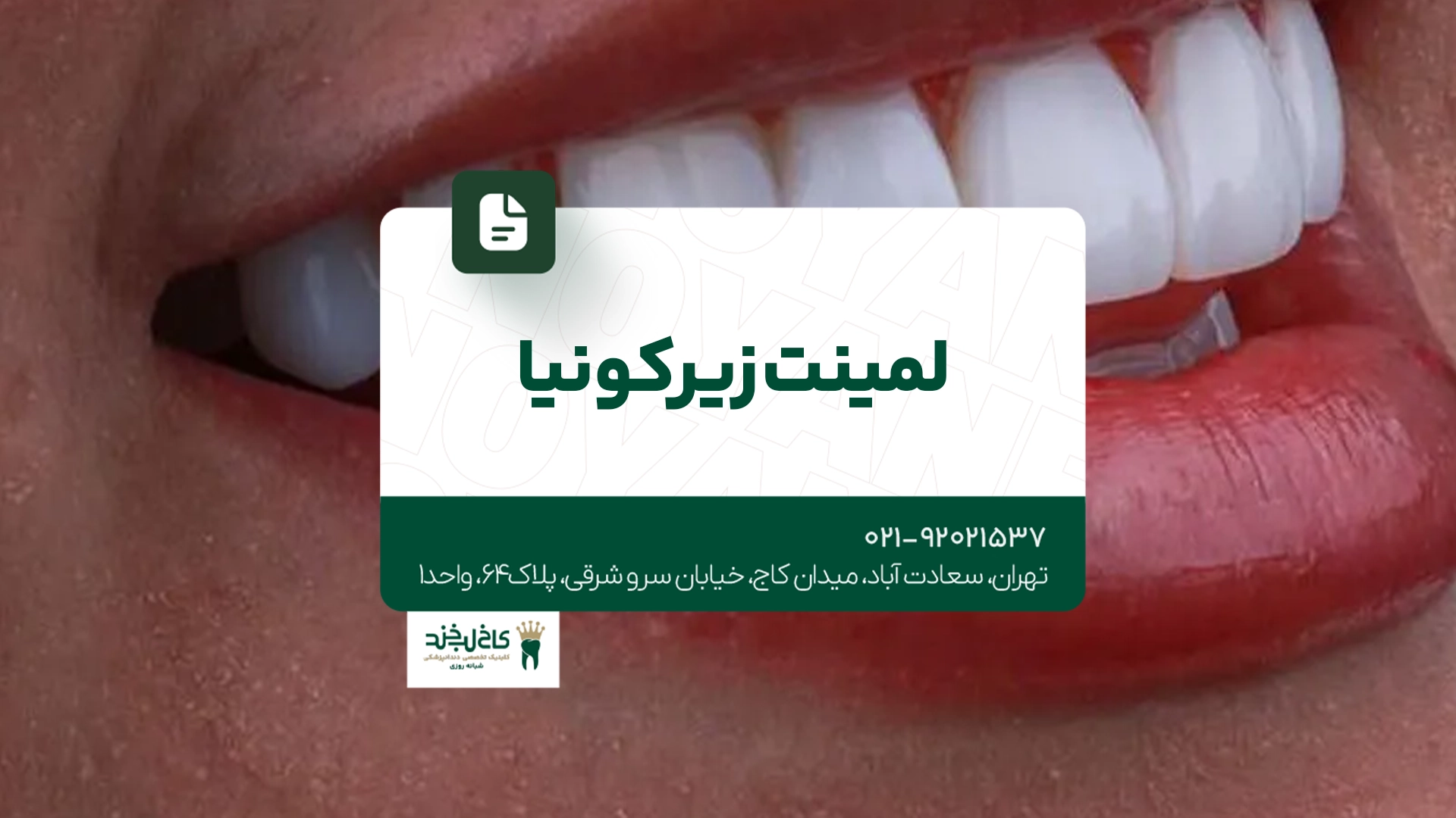 لمینت زیرکونیا