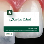 لمینت سرامیکی