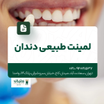 لمینت طبیعی دندان