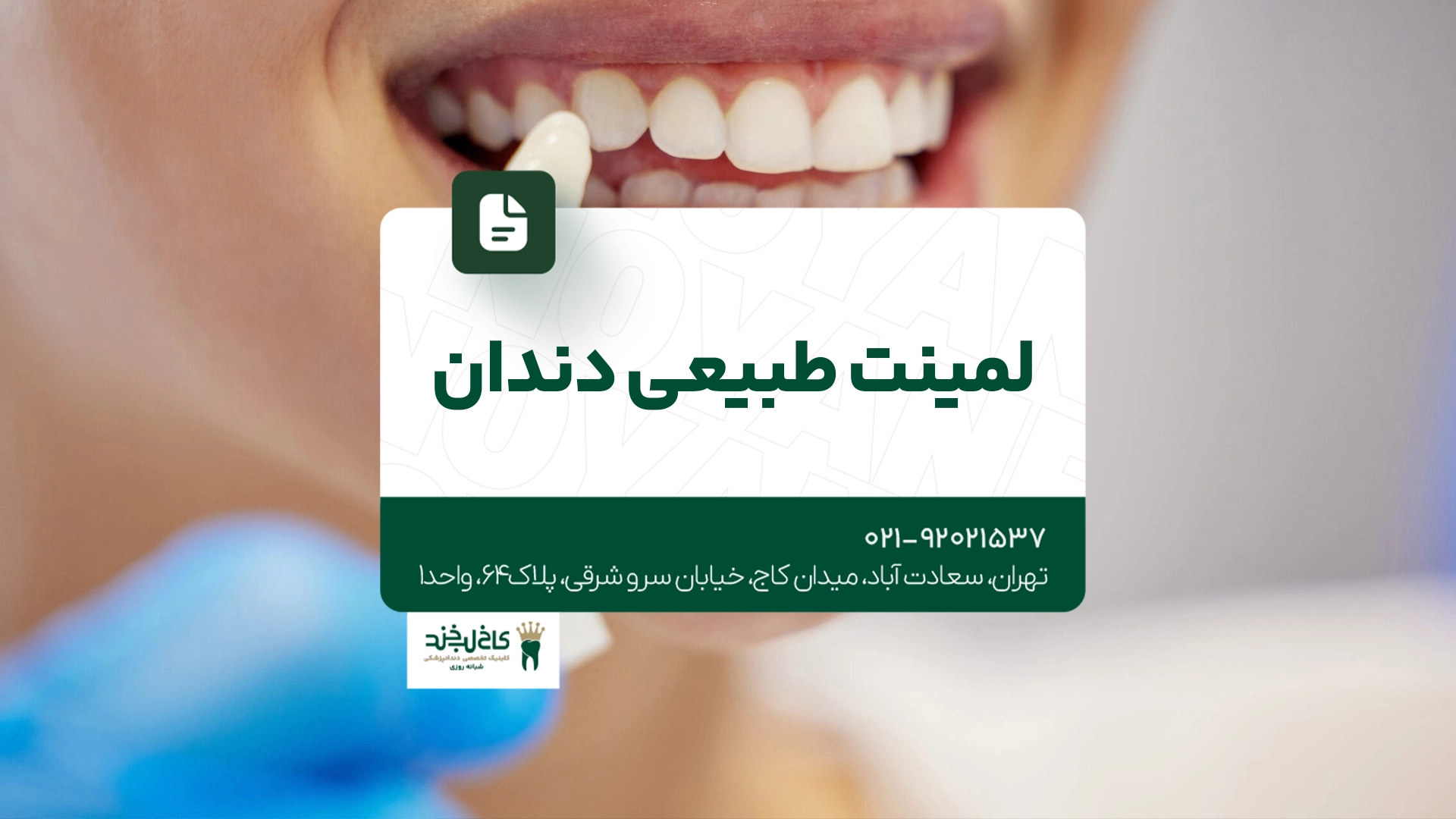 لمینت طبیعی دندان