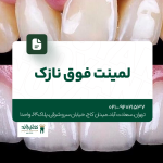 لمینت فوق نازک