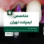 متخصص ایمپلنت تهران