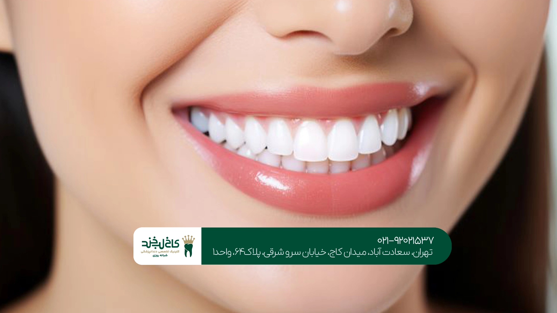 بهترین دندانپزشکی زیبایی