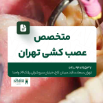 متخصص عصب کشی تهران