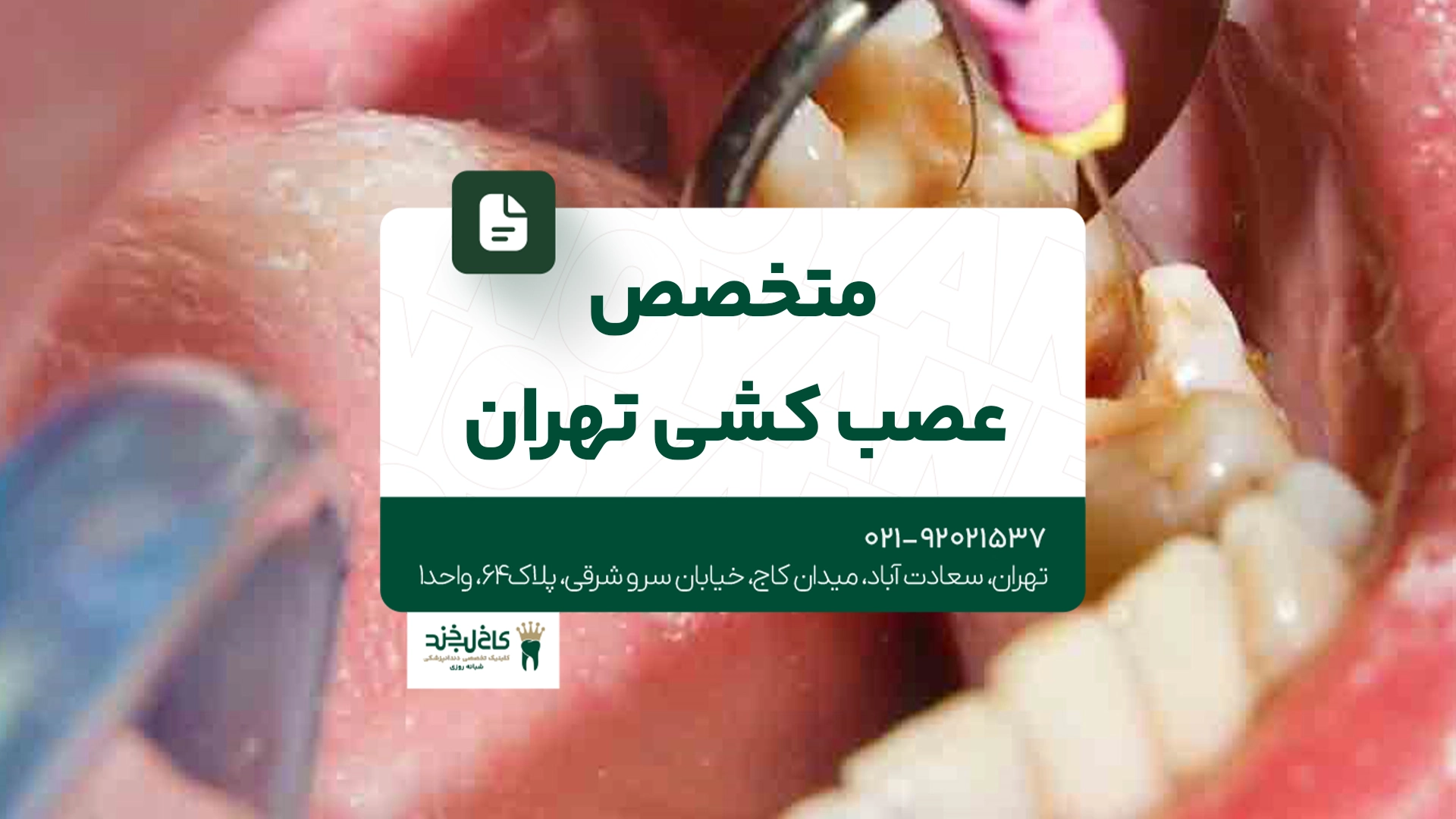 متخصص عصب کشی تهران متخصص عصب کشی تهران