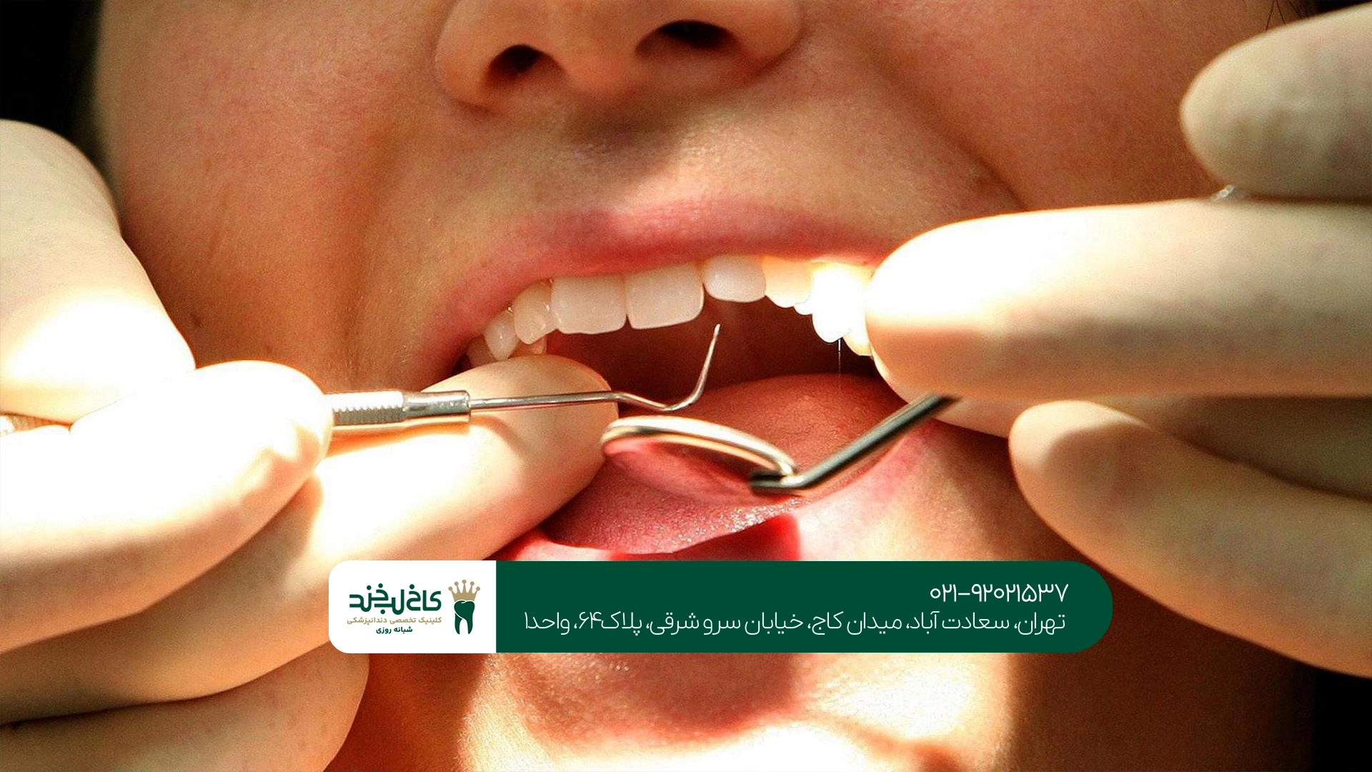 بهترین دندانپزشک عصبکشی تهران بهترین دندانپزشک عصبکشی تهران