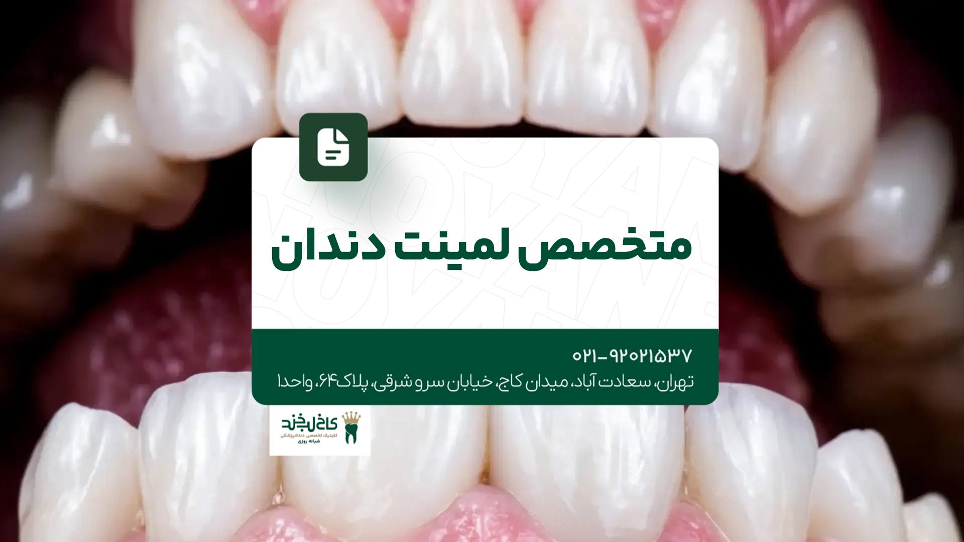 متخصص لمینت دندان