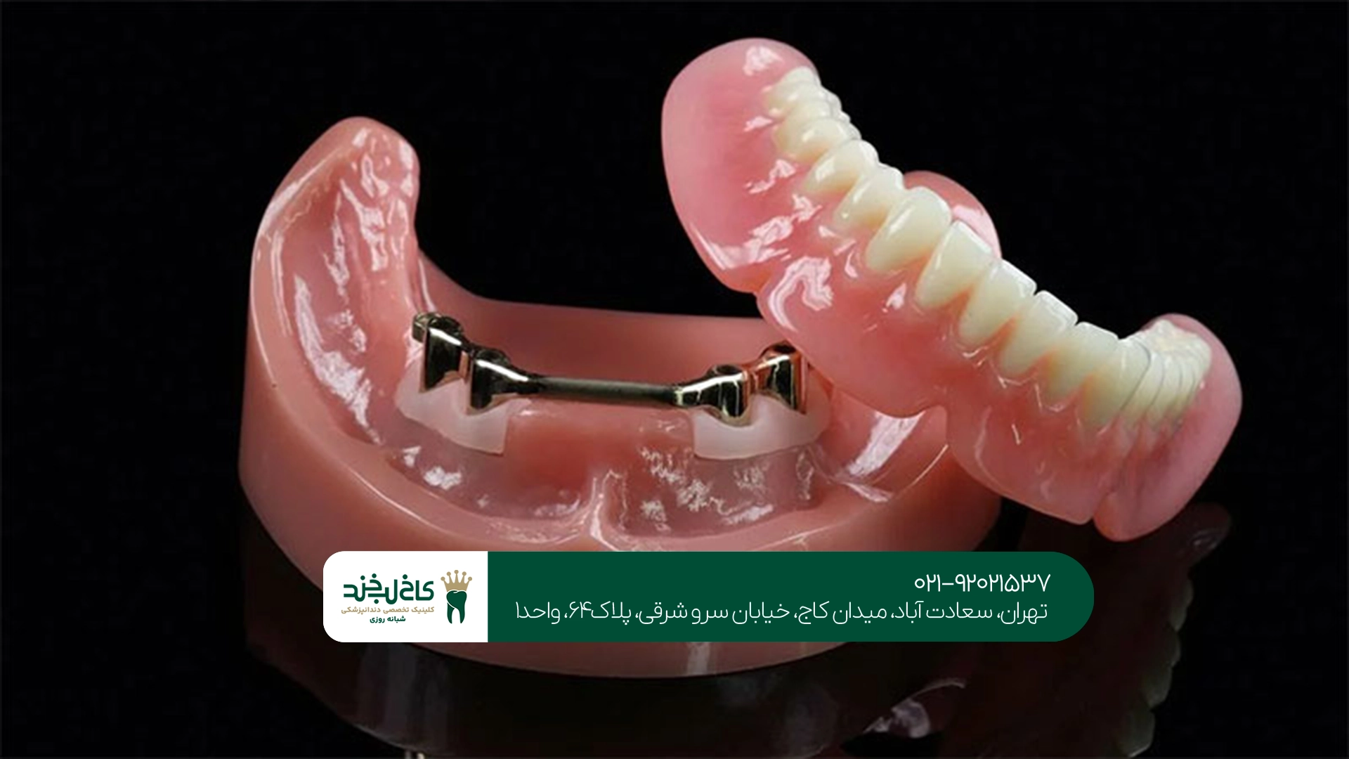 متخصص پروتز دندان در تهران