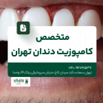 متخصص کامپوزیت دندان تهران