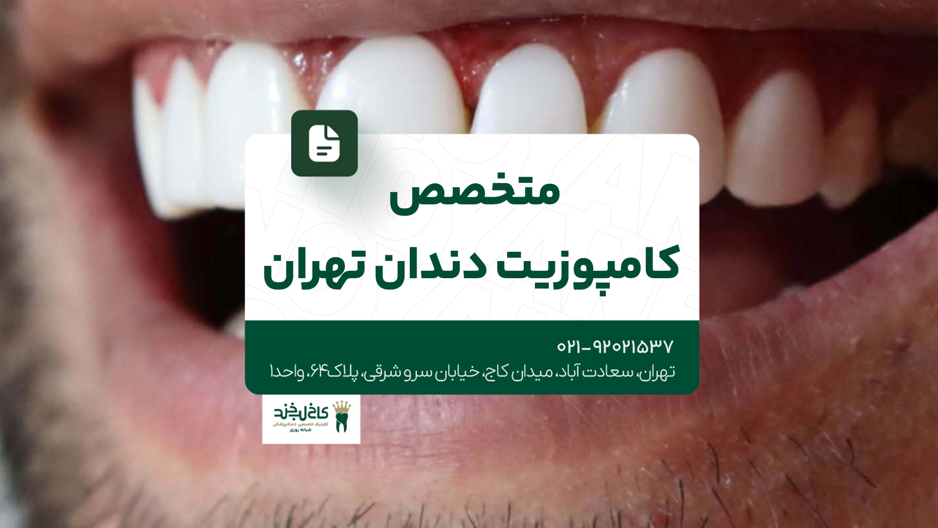 متخصص کامپوزیت دندان تهران