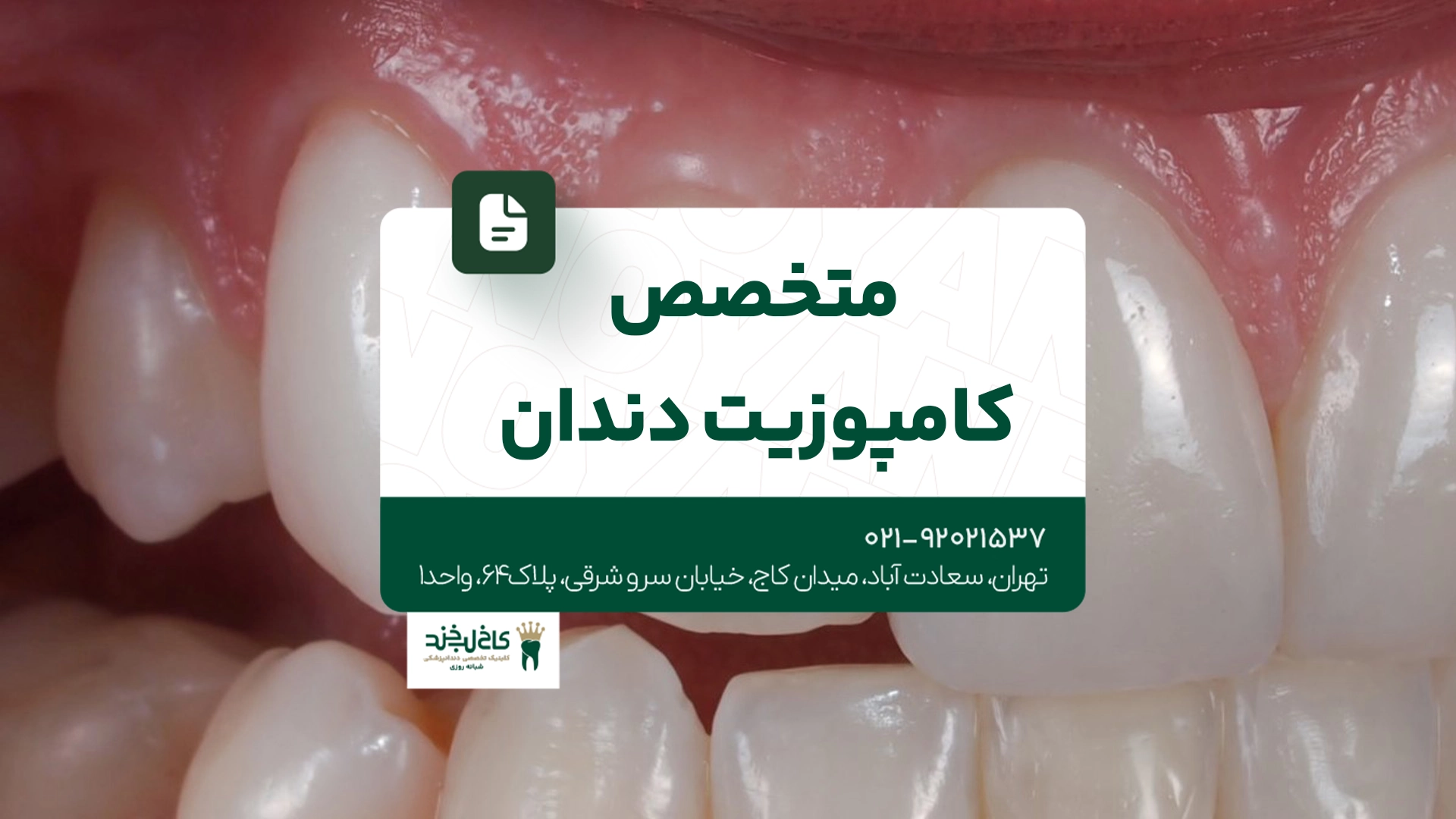 متخصص کامپوزیت دندان