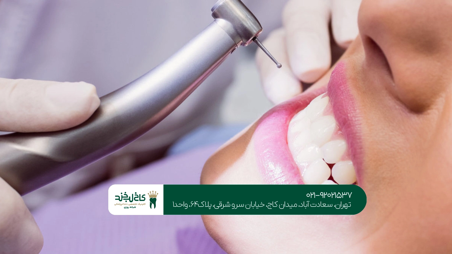 بهترین متخصص کامپوزیت دندان