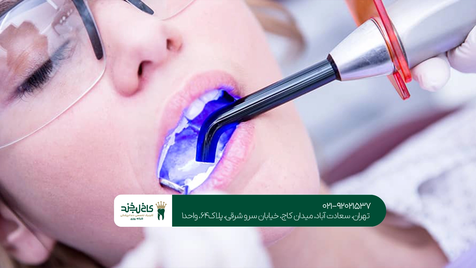 کامپوزیت دندان برای چه افرادی مناسب است؟