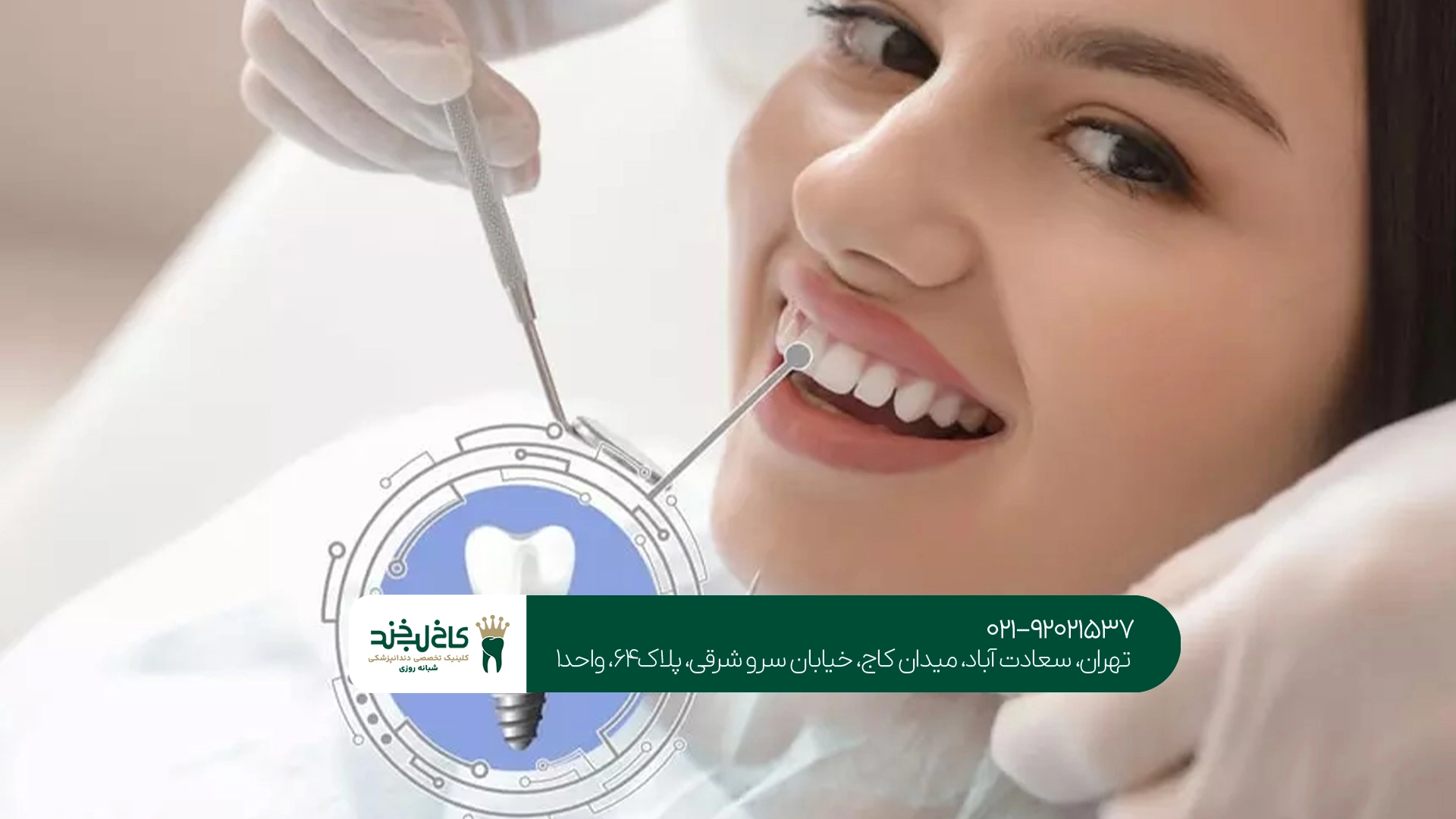 بهترین مرکز تخصصی ایمپلنت تهران