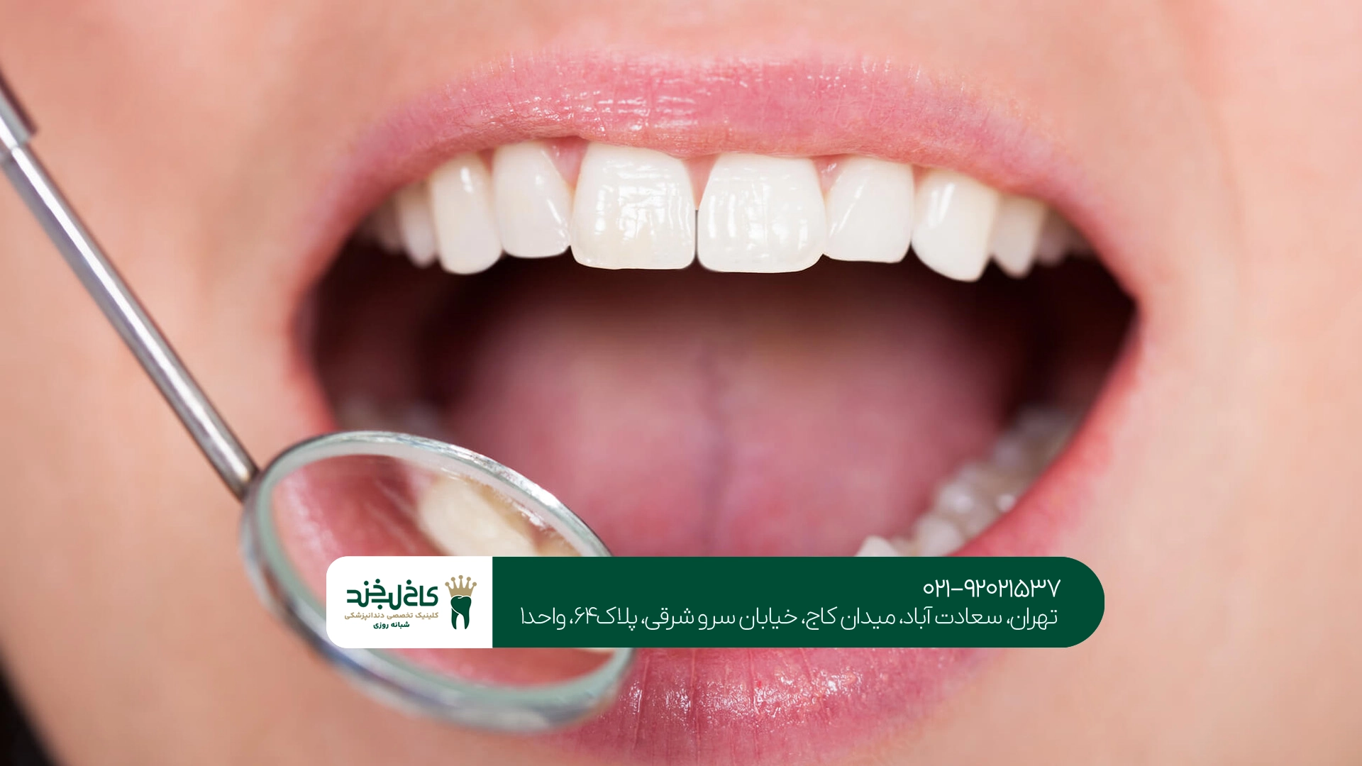 مرکز تخصصی زیبایی دندان تهران