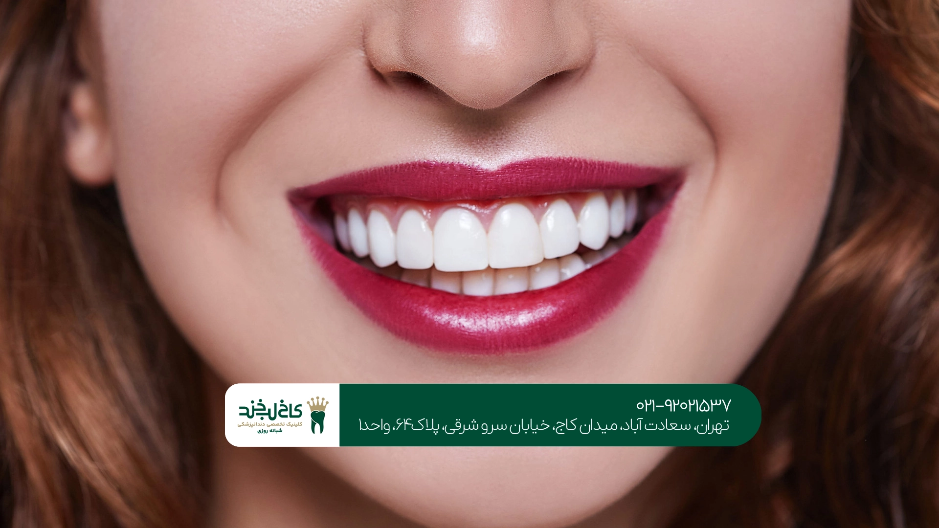 بهترین مرکز زیبایی دندان تهران