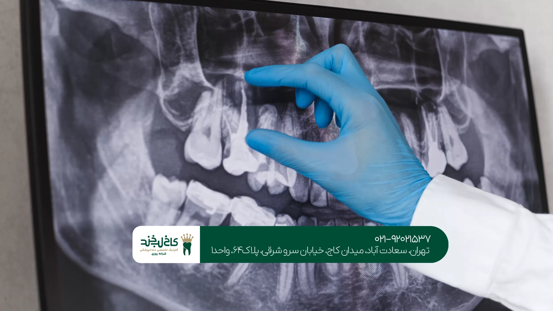 عکسبرداری دندان در معاینه اولیه چه مشکلاتی را مشخص میکند؟