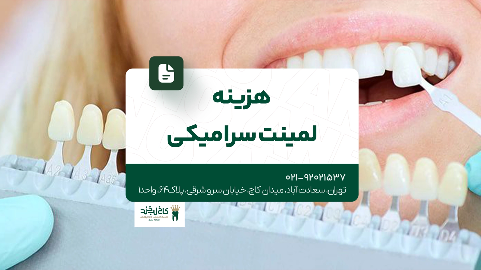 هزینه لمینت سرامیکی