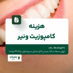 هزینه کامپوزیت ونیر