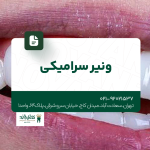 ونیر سرامیکی