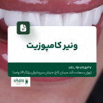 ونیر کامپوزیت
